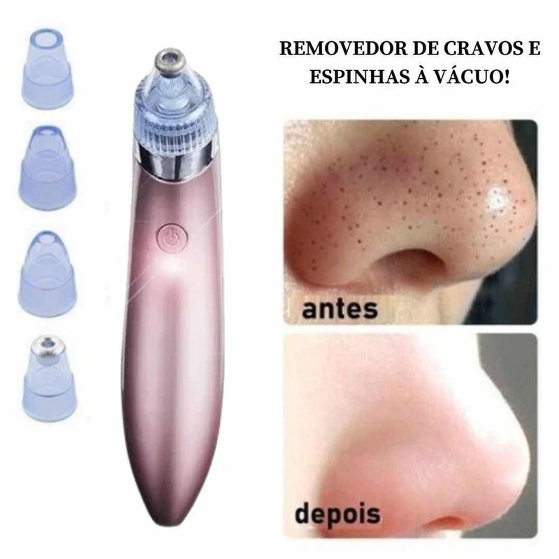 Removedor de Cravos e Espinhas à Vácuo - ClearSkin